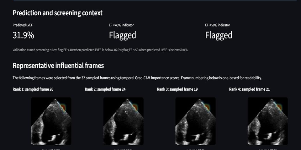 Echocardiography-Based LVEF Estimation with Explainable AI